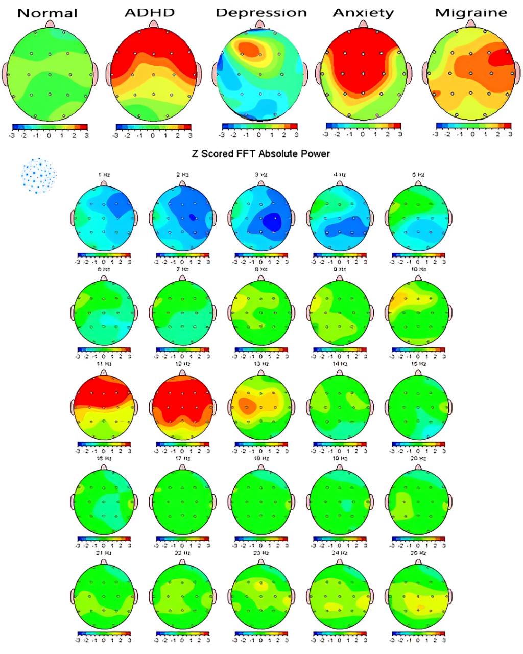 Paquete sistema( Software ) Mapeo cerebral de emociones, seguimiento y visualización de recorridos emocionales.